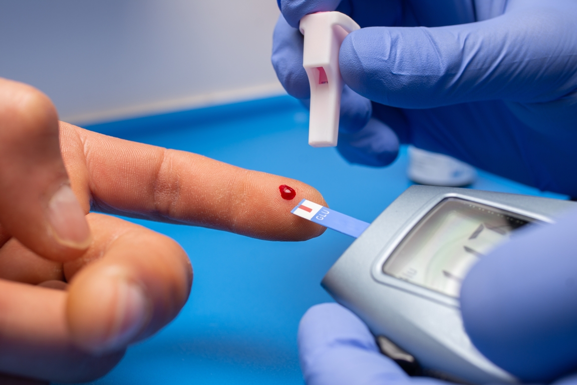 Gestational Diabetes Test Preparation